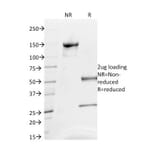 SDS-PAGE - Anti-CD63 Antibody [NKI/C3] - BSA and Azide free (A253926) - Antibodies.com