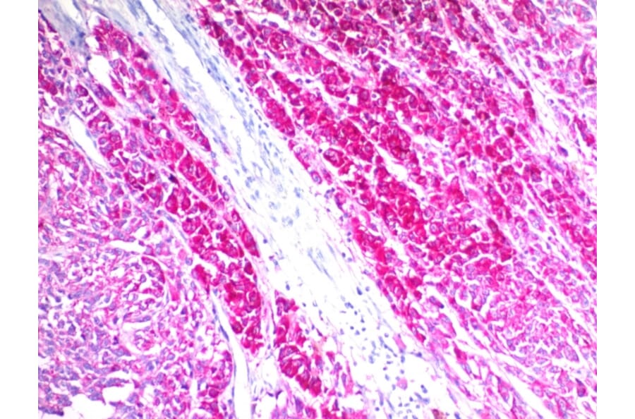 Immunohistochemistry - Anti-CD63 Antibody [SPM524] - BSA and Azide free (A253926) - Antibodies.com