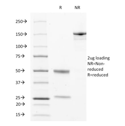 SDS-PAGE - Anti-CD63 Antibody [LAMP3/529] - BSA and Azide free (A253929) - Antibodies.com