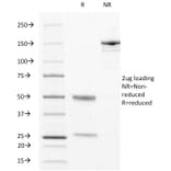 SDS-PAGE - Anti-CD63 Antibody [LAMP3/529] - BSA and Azide free (A253929) - Antibodies.com