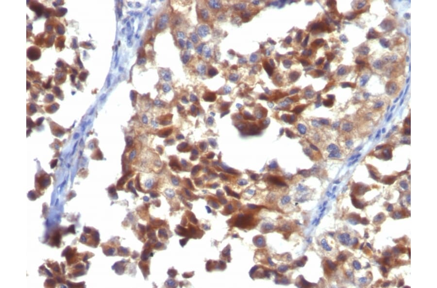 Immunohistochemistry - Anti-CD63 Antibody [LAMP3/968] - BSA and Azide free (A253930) - Antibodies.com