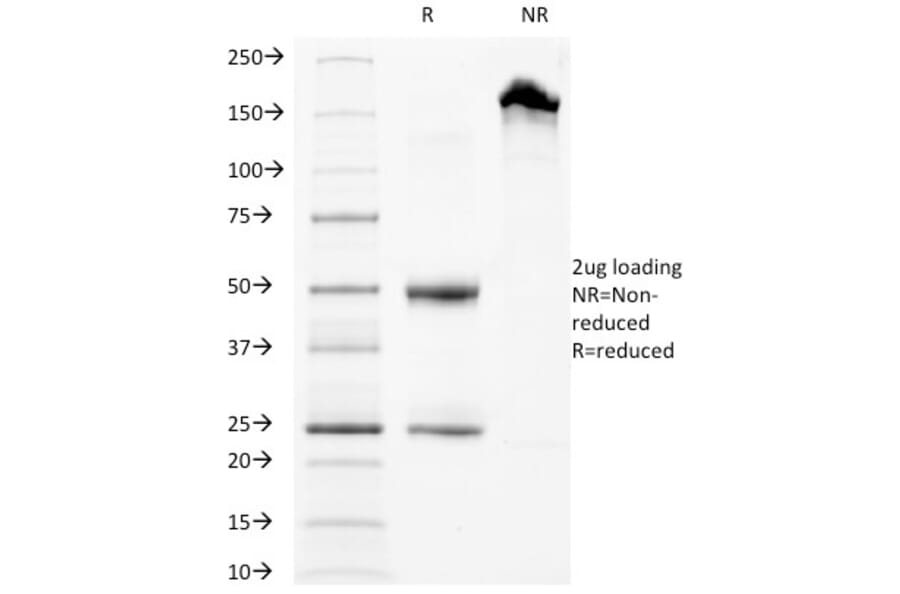 SDS-PAGE - Anti-CD63 Antibody [LAMP3/968] - BSA and Azide free (A253930) - Antibodies.com