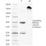 SDS-PAGE - Anti-CD63 Antibody [LAMP3/968] - BSA and Azide free (A253930) - Antibodies.com