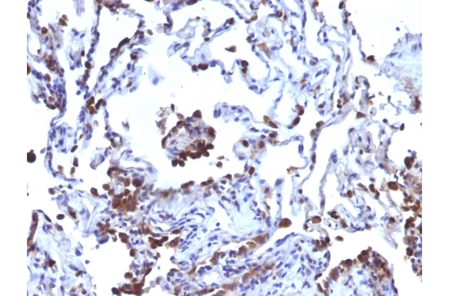 Immunohistochemistry - Anti-CD63 Antibody [NKI/C3 + LAMP3/968] - BSA and Azide free (A253930) - Antibodies.com