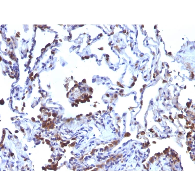 Immunohistochemistry - Anti-CD63 Antibody [NKI/C3 + LAMP3/968] - BSA and Azide free (A253930) - Antibodies.com