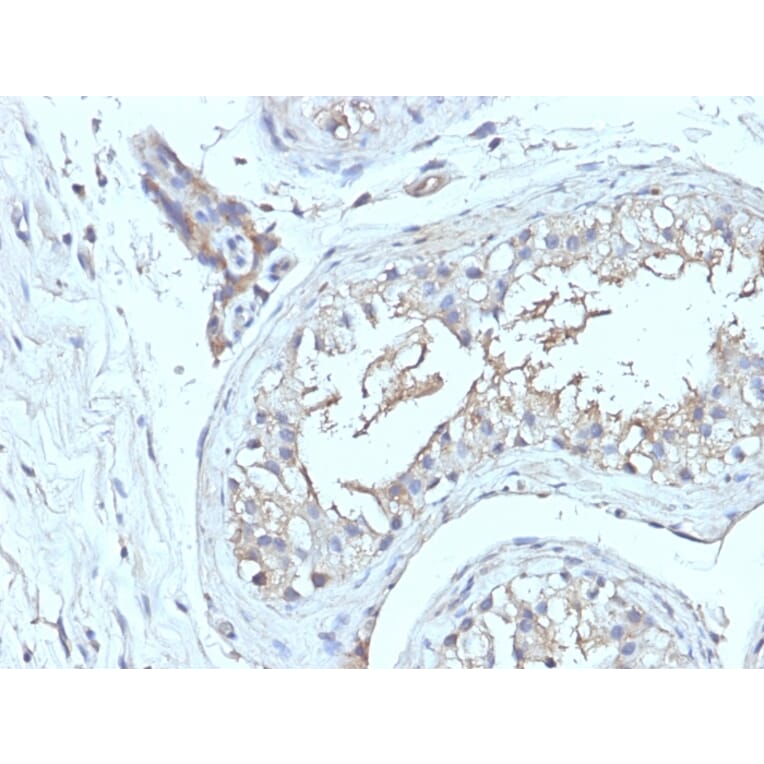 Immunohistochemistry - Anti-CD63 Antibody [NKI/C3 + LAMP3/968] - BSA and Azide free (A253931) - Antibodies.com