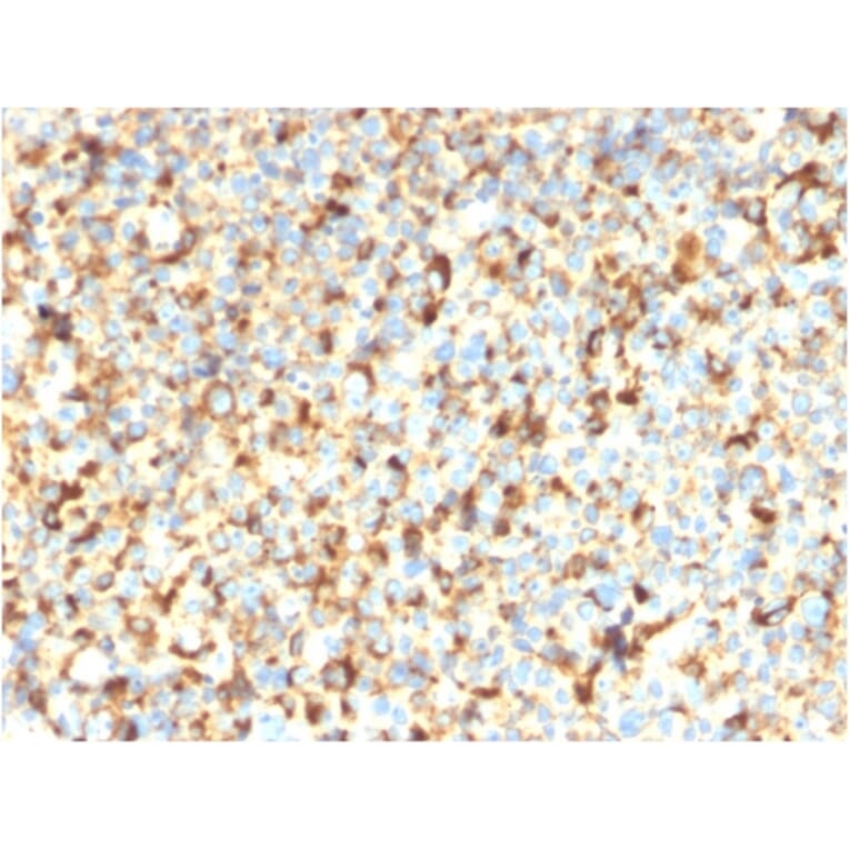 Immunohistochemistry - Anti-CD63 Antibody [rMX-49.129.5] - BSA and Azide free (A253932) - Antibodies.com