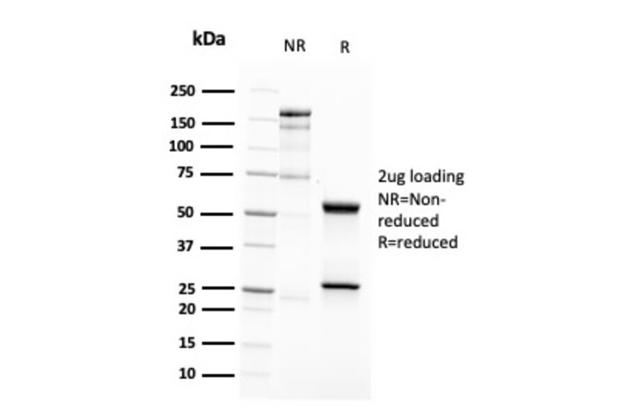 SDS-PAGE - Anti-CD63 Antibody [LAMP3/2788] - BSA and Azide free (A253933) - Antibodies.com