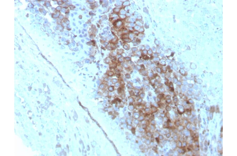 Immunohistochemistry - Anti-CD63 Antibody [LAMP3/2789] - BSA and Azide free (A253934) - Antibodies.com