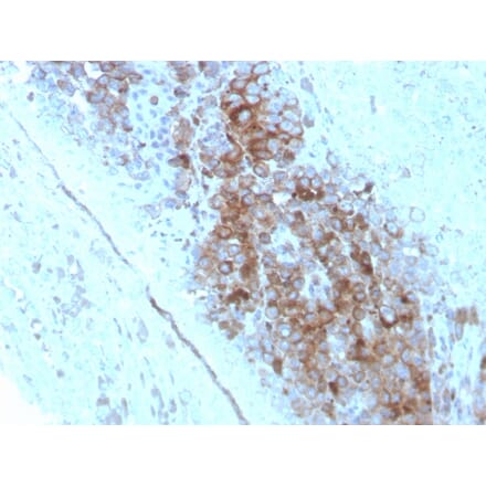 Immunohistochemistry - Anti-CD63 Antibody [LAMP3/2789] - BSA and Azide free (A253934) - Antibodies.com