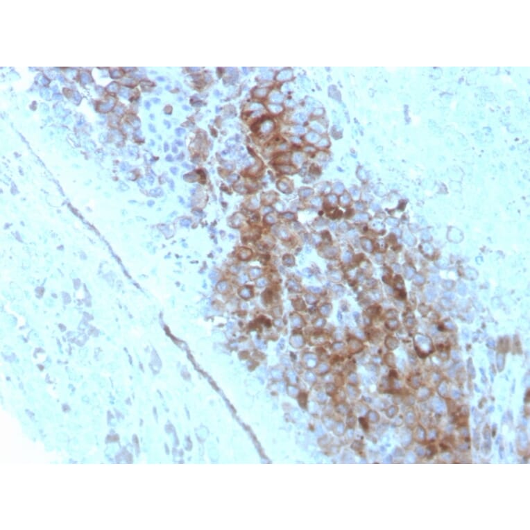 Immunohistochemistry - Anti-CD63 Antibody [LAMP3/2789] - BSA and Azide free (A253934) - Antibodies.com