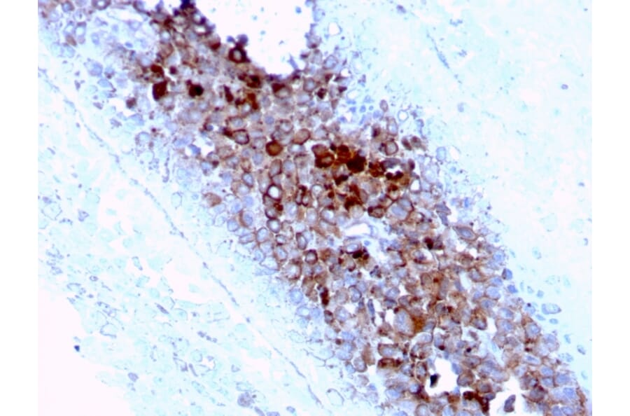 Immunohistochemistry - Anti-CD63 Antibody [LAMP3/2789] - BSA and Azide free (A253934) - Antibodies.com