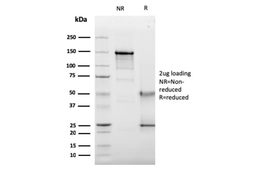 SDS-PAGE - Anti-CD63 Antibody [LAMP3/2789] - BSA and Azide free (A253934) - Antibodies.com