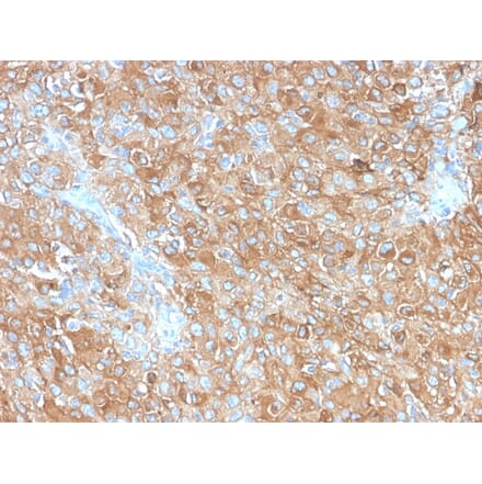 Immunohistochemistry - Anti-CD63 Antibody [LAMP3/2990R] - BSA and Azide free (A253935) - Antibodies.com