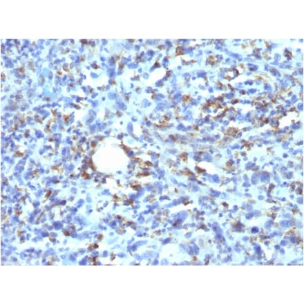 Immunohistochemistry - Anti-CD68 Antibody [rLAMP4/824] - BSA and Azide free (A253936) - Antibodies.com