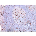 Immunohistochemistry - Anti-CD68 Antibody [SPM130] - BSA and Azide free (A253937) - Antibodies.com