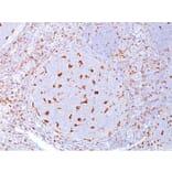 Immunohistochemistry - Anti-CD68 Antibody [C68/684] - BSA and Azide free (A253939) - Antibodies.com