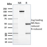 SDS-PAGE - Anti-CD68 Antibody [C68/684] - BSA and Azide free (A253939) - Antibodies.com