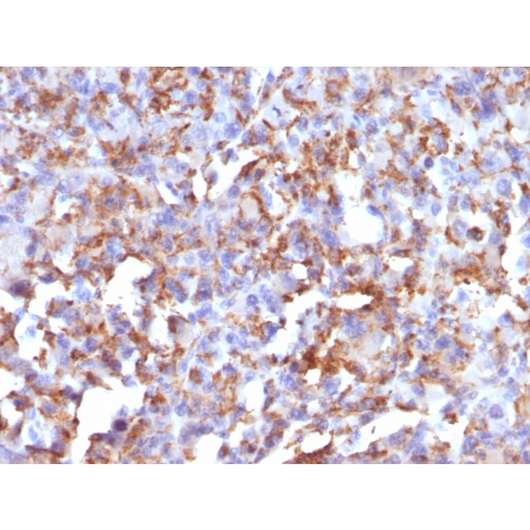 Immunohistochemistry - Anti-CD68 Antibody [LAMP4/824] - BSA and Azide free (A253941) - Antibodies.com