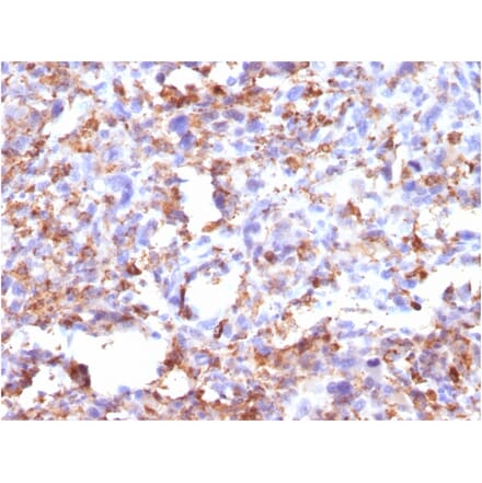 Immunohistochemistry - Anti-CD68 Antibody [CD68/G2] - BSA and Azide free (A253941) - Antibodies.com