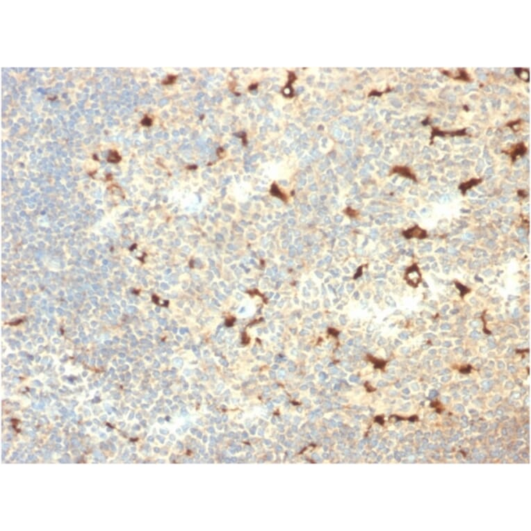 Immunohistochemistry - Anti-CD68 Antibody [C68/2709] - BSA and Azide free (A253946) - Antibodies.com