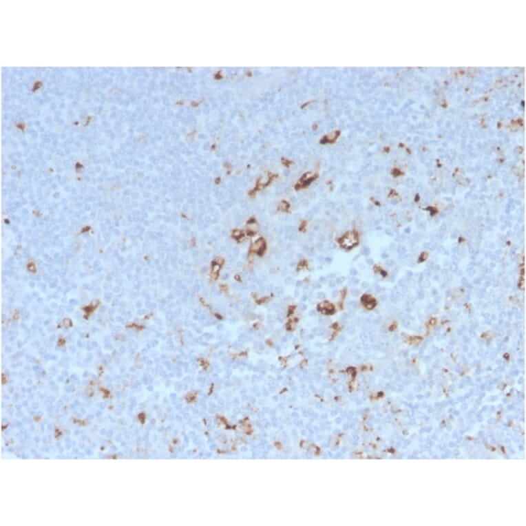 Immunohistochemistry - Anti-CD68 Antibody [C68/2908R] - BSA and Azide free (A253946) - Antibodies.com