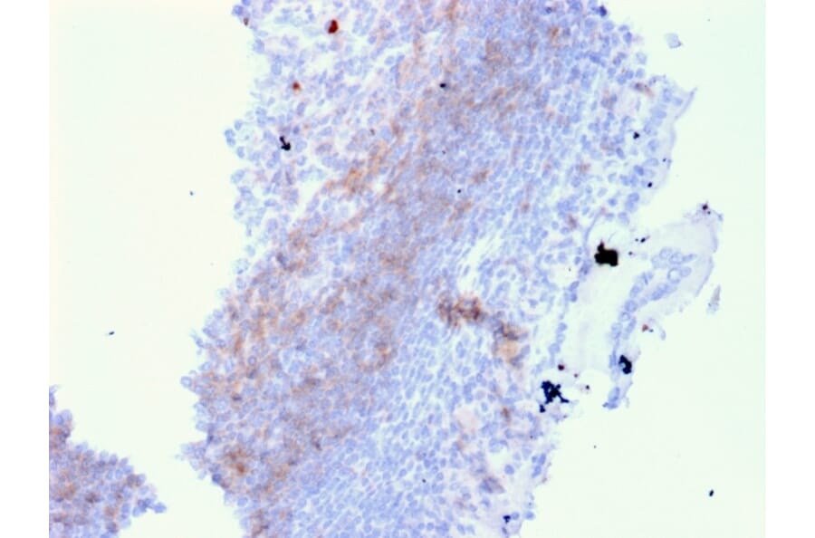 Immunohistochemistry - Anti-CD72 Antibody [BU40] - BSA and Azide free (A253947) - Antibodies.com