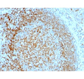 Immunohistochemistry - Anti-CD74 Antibody [LN-2] - BSA and Azide free (A253951) - Antibodies.com
