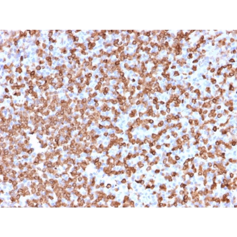 Immunohistochemistry - Anti-CD74 Antibody [LN-2] - BSA and Azide free (A253951) - Antibodies.com