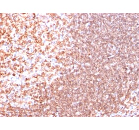 Immunohistochemistry - Anti-CD74 Antibody [SPM523] - BSA and Azide free (A253952) - Antibodies.com
