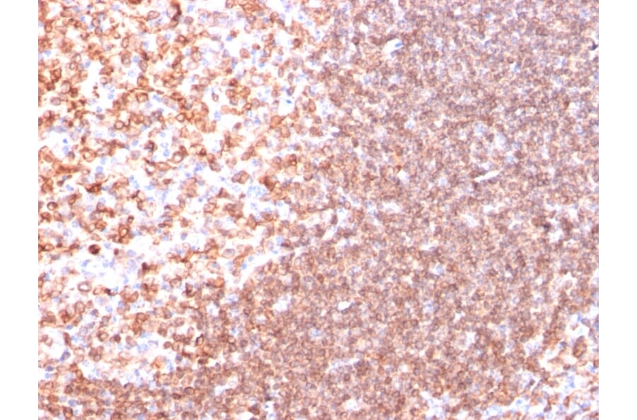 Immunohistochemistry - Anti-CD74 Antibody [SPM523] - BSA and Azide free (A253952) - Antibodies.com