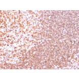 Immunohistochemistry - Anti-CD74 Antibody [SPM523] - BSA and Azide free (A253952) - Antibodies.com