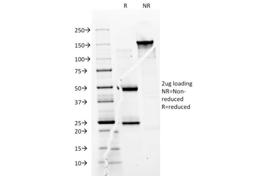 SDS-PAGE - Anti-CD74 Antibody [BU45] - BSA and Azide free (A253952) - Antibodies.com