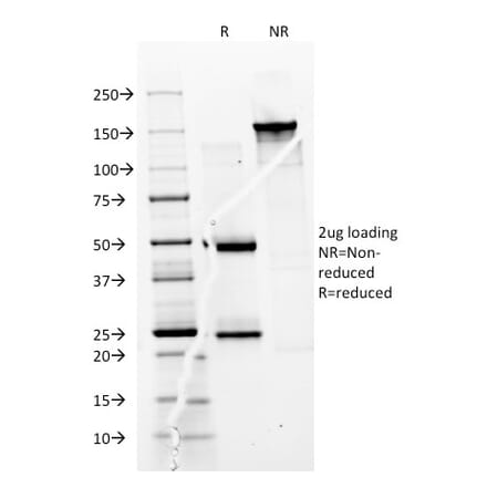 SDS-PAGE - Anti-CD74 Antibody [BU45] - BSA and Azide free (A253952) - Antibodies.com