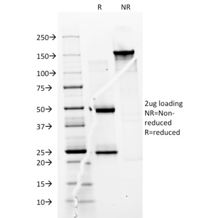 SDS-PAGE - Anti-CD74 Antibody [BU45] - BSA and Azide free (A253952) - Antibodies.com