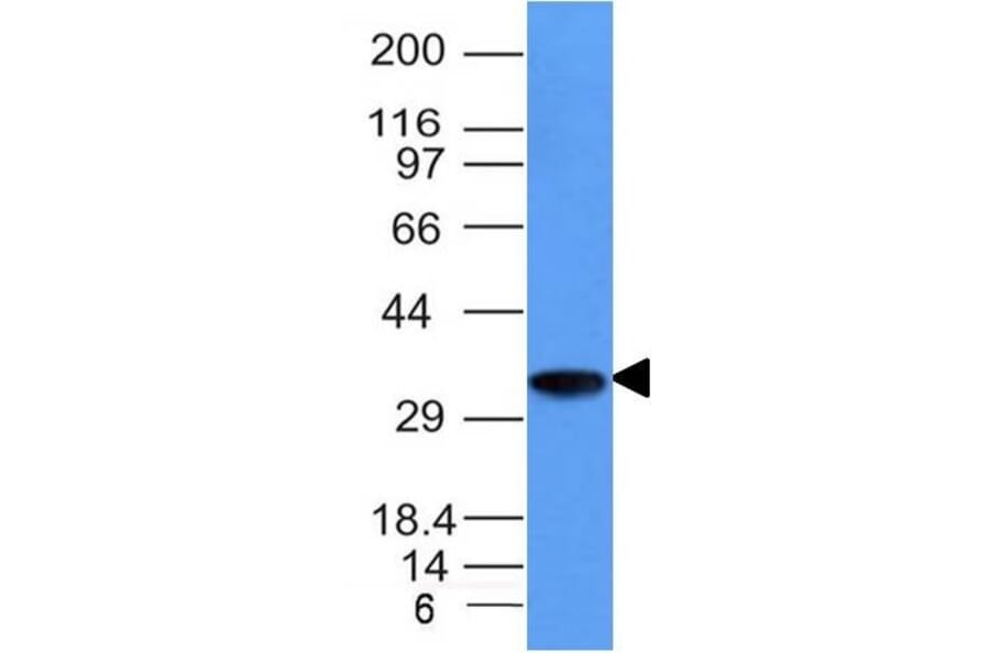 Western Blot - Anti-CD74 Antibody [CLIP/1133] - BSA and Azide free (A253954) - Antibodies.com