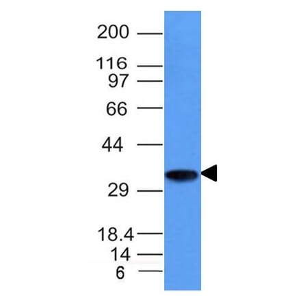 Western Blot - Anti-CD74 Antibody [CLIP/1133] - BSA and Azide free (A253954) - Antibodies.com