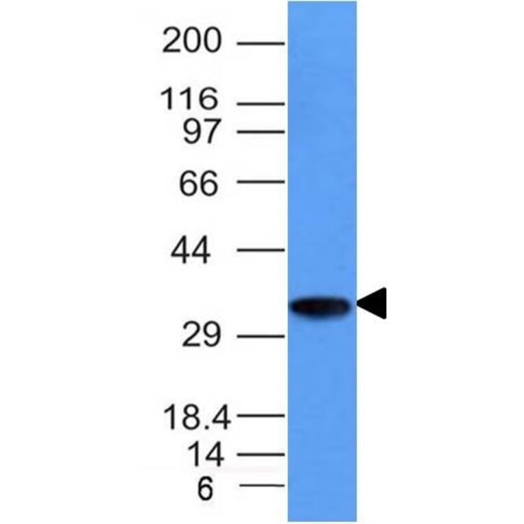 Western Blot - Anti-CD74 Antibody [CLIP/1133] - BSA and Azide free (A253954) - Antibodies.com