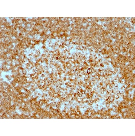 Immunohistochemistry - Anti-CD74 Antibody [LN-2 + CLIP/813] - BSA and Azide free (A253956) - Antibodies.com