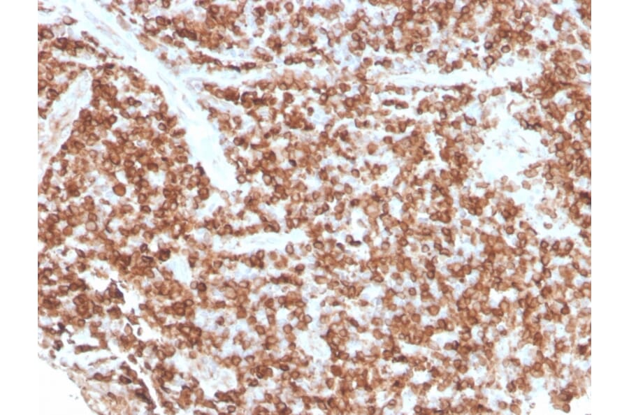 Immunohistochemistry - Anti-CD74 Antibody [rCLIP/813] - BSA and Azide free (A253956) - Antibodies.com