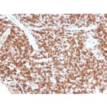 Immunohistochemistry - Anti-CD74 Antibody [rCLIP/813] - BSA and Azide free (A253956) - Antibodies.com