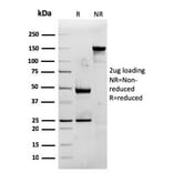 SDS-PAGE - Anti-CD74 Antibody [rCLIP/813] - BSA and Azide free (A253957) - Antibodies.com