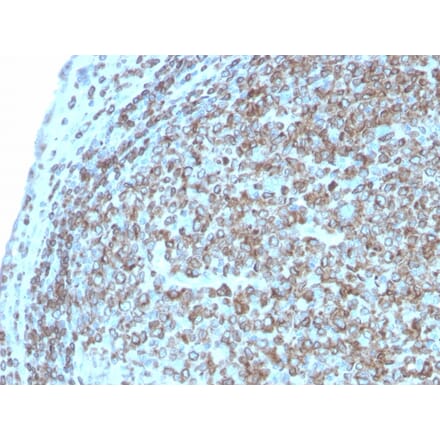 Immunohistochemistry - Anti-CD74 Antibody [CLIP/3127R] - BSA and Azide free (A253958) - Antibodies.com