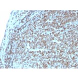 Immunohistochemistry - Anti-CD74 Antibody [CLIP/3127R] - BSA and Azide free (A253958) - Antibodies.com