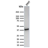 Western Blot - Anti-CD74 Antibody [CLIP/3127R] - BSA and Azide free (A253958) - Antibodies.com