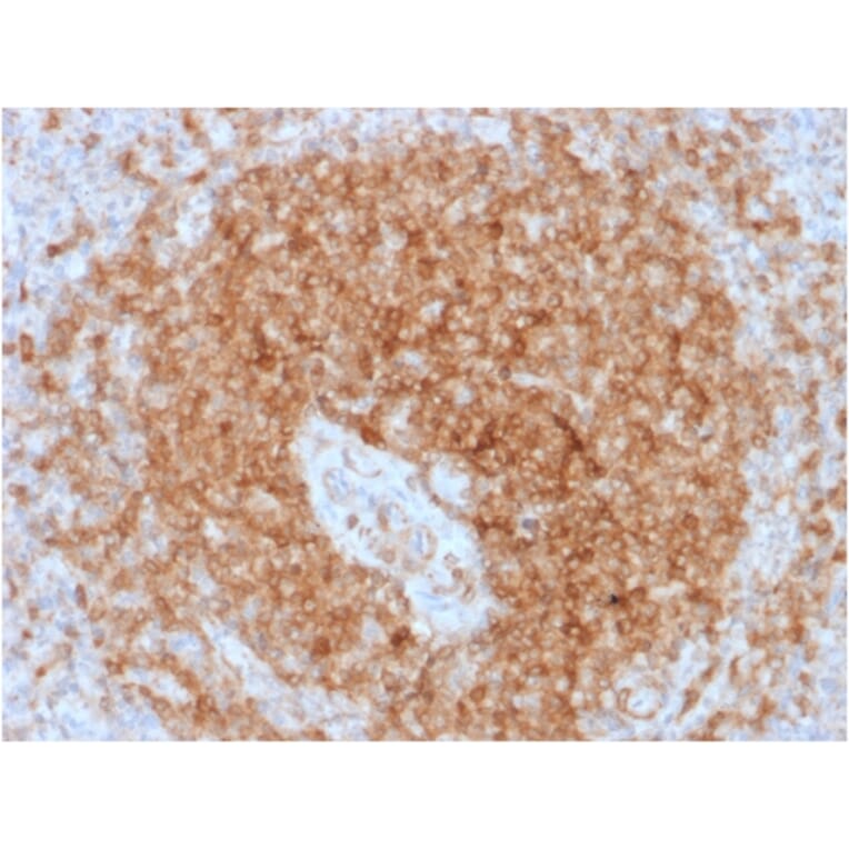 Immunohistochemistry - Anti-CD79a Antibody [rIGA/764] - BSA and Azide free (A253959) - Antibodies.com