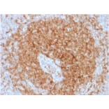 Immunohistochemistry - Anti-CD79a Antibody [rIGA/764] - BSA and Azide free (A253959) - Antibodies.com