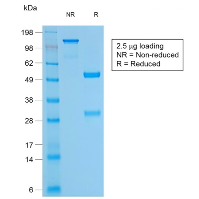 SDS-PAGE - Anti-CD79a Antibody [rIGA/764] - BSA and Azide free (A253959) - Antibodies.com