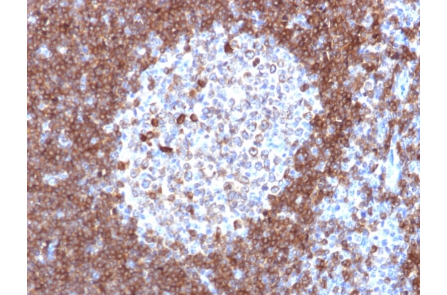 Immunohistochemistry - Anti-CD79a Antibody [JCB117] - BSA and Azide free (A253961) - Antibodies.com