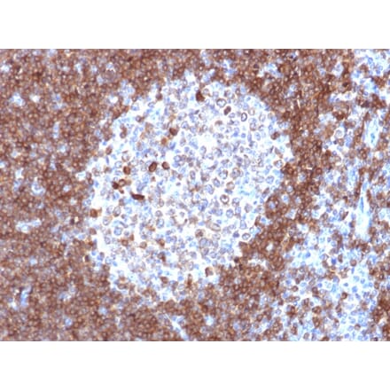 Immunohistochemistry - Anti-CD79a Antibody [JCB117] - BSA and Azide free (A253961) - Antibodies.com